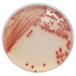 CHROMagar Acinetobacter (5L)